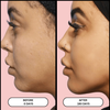 FaceX™ - Facial Therapy Sculptor