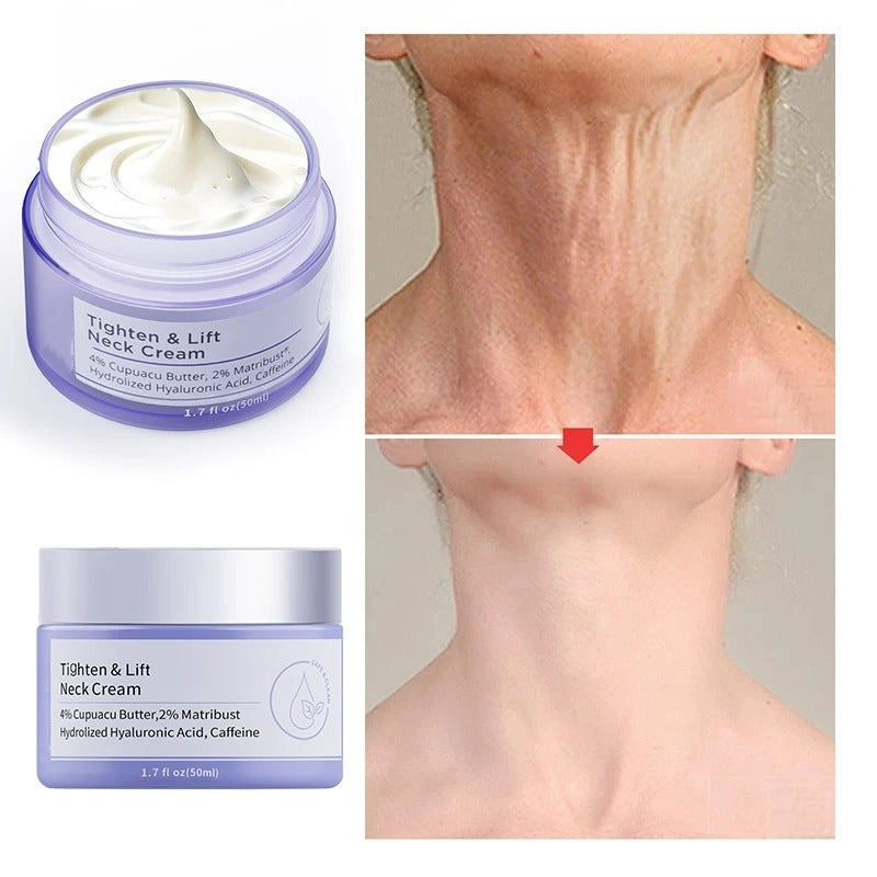 Neckya™ - Tighten & Lift Neck Cream